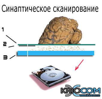 сканирование мозга